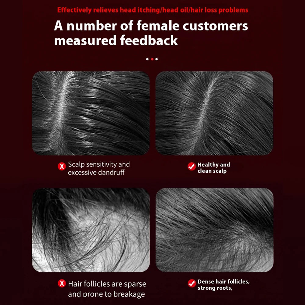 scalp brush  scalp scrub brush scalp massage brush scalping brush scalp exfoliation brush scalp exfoliating brush   scalp massage with brush  scalp massager brush scalp massaging brush exfoliate scalp with brush