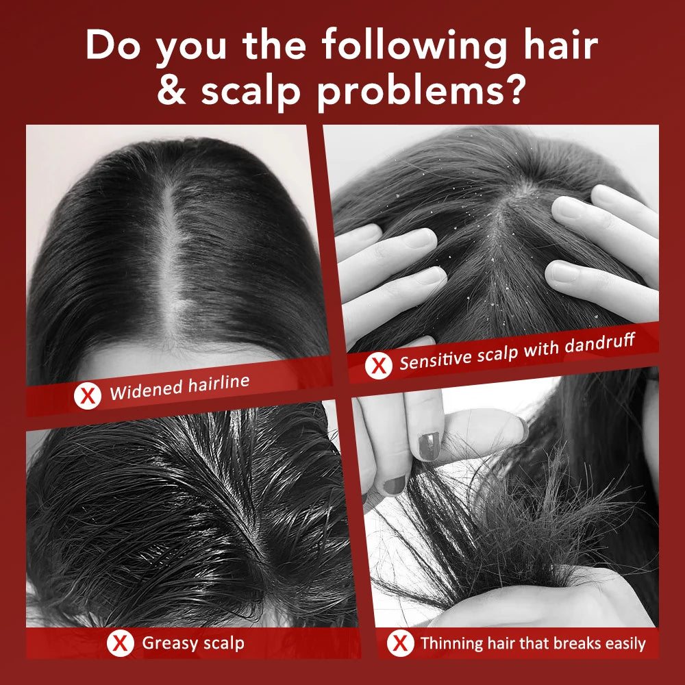 scalp brush  scalp scrub brush scalp massage brush scalping brush scalp exfoliation brush scalp exfoliating brush   scalp massage with brush  scalp massager brush scalp massaging brush exfoliate scalp with brush